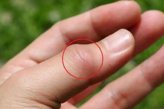 玩游戏手指很涩怎么办_玩手机游戏手指比较涩_用手指玩的那个游戏叫什么